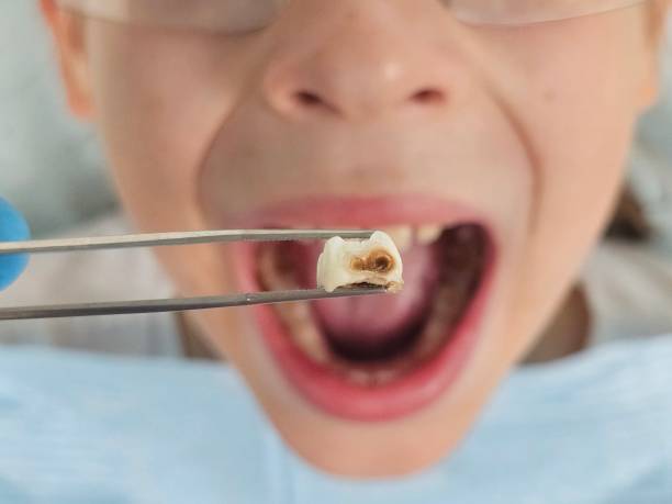 Best Pediatric Emergency Dentist in Rock Hill, SC